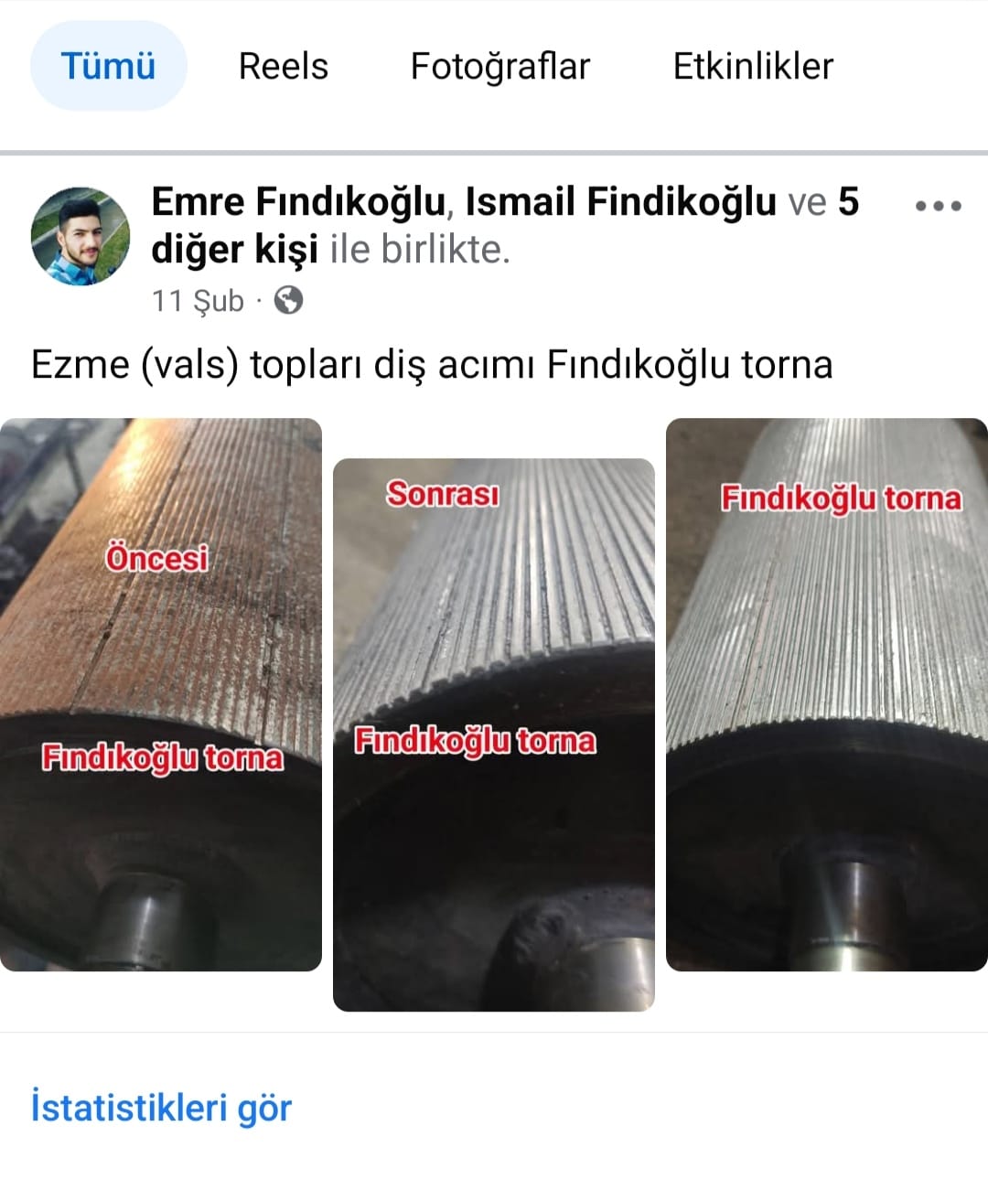 vals ezme topları diş acımı detaylı bilgi için 05453306514